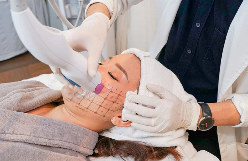 Công nghệ RF giúp tìm lại nét thanh xuân của làn da (Ảnh: Long Châu)