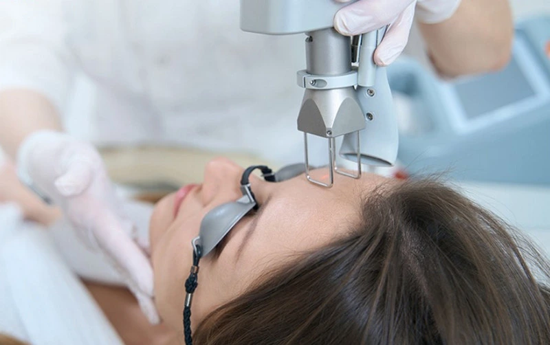 Công nghệ laser trẻ hóa da (Ảnh: Tâm Anh)